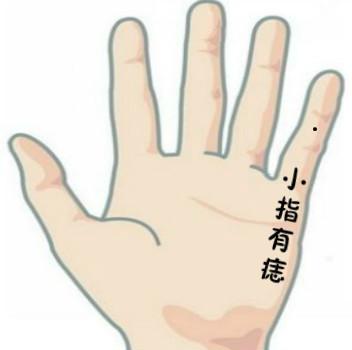 痣相 吉凶|手指上有痣代表什么？ 哪个手指有痣桃花较多？